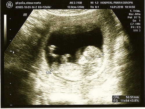 Complicações na gravidez: técnicas inovadoras