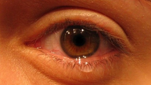 olho-triste-500x282