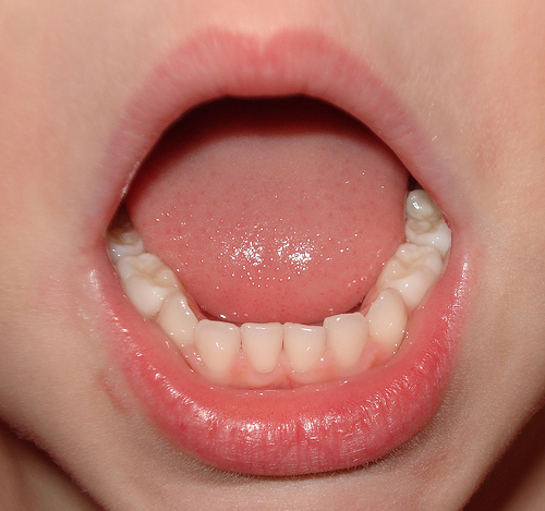 cuidar dos dentes de leite