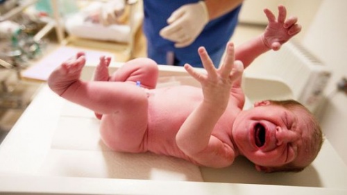 A importância do teste de Apgar em recém-nascidos