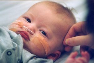 A luta de uma mãe pela saúde de seu filho