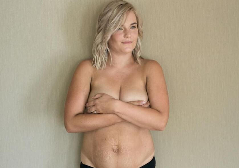 Uma mãe mostra seu corpo depois de dar à luz em defesa da beleza do corpo feminino