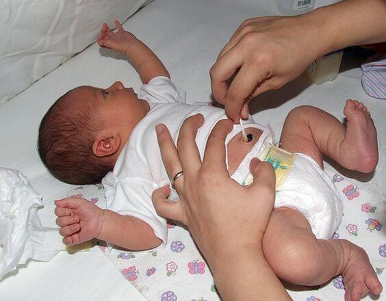 cortar o cordão umbilical