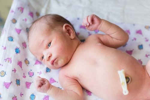 Os 6 erros mais comuns no cuidado do umbigo do bebê