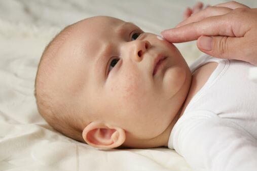 O Que Sao Essas Manchinhas Vermelhas Na Pele Do Bebe Sou Mamae