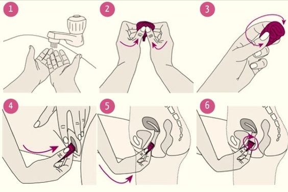 coletor menstrual