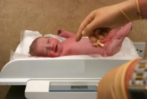 A perda de peso em recém-nascidos