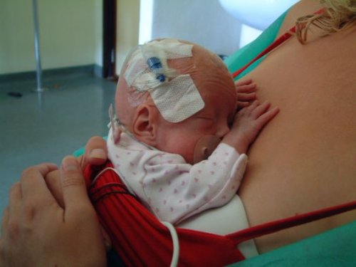 As consequências de não amamentar um bebê prematuro