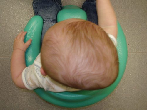 síndrome da cabeça chata