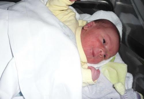 acne neonatal