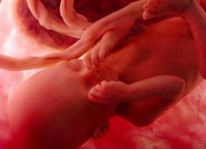 7 sinais de sofrimento fetal