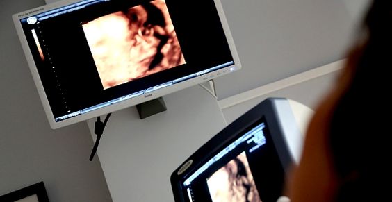 sofrimento fetal