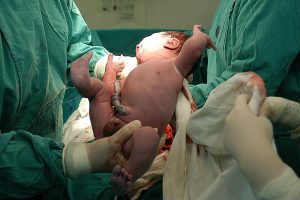 6 cuidados que o bebê recebe logo após o nascimento