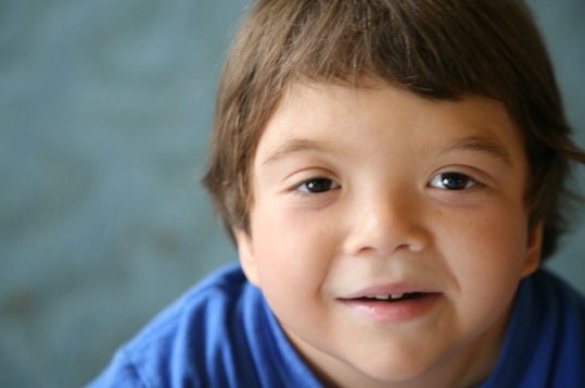 síndrome de klinefelter