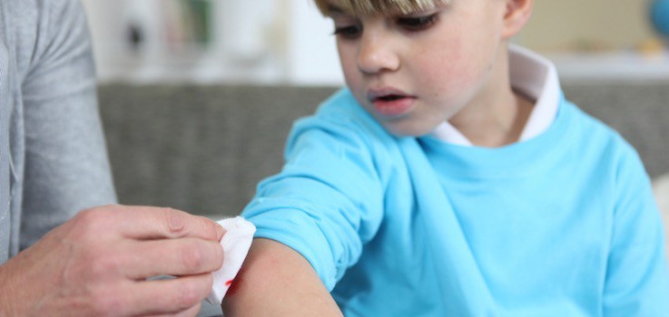 menino machucado no braço e sendo cuidado pela mãe