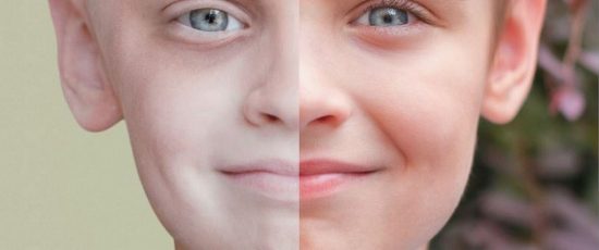 sintomas de leucemia em crianças