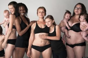 5 conselhos para você se recuperar da diástase abdominal