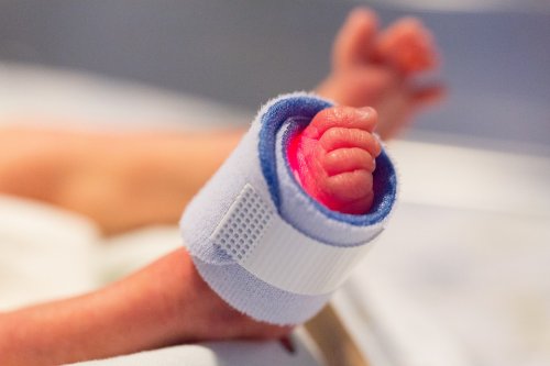 Como prevenir um parto prematuro