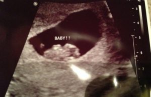 O método Ramzi para conhecer o sexo do bebê