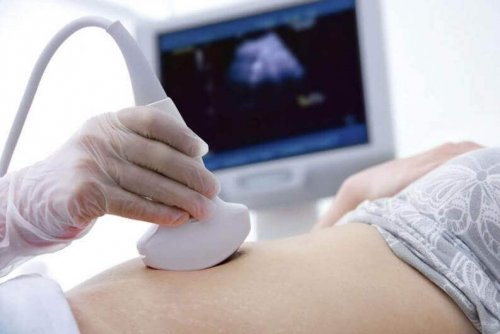 mulher grávida fazendo uma ecografia