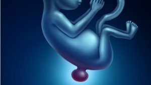 Bebês que nascem com a espinha bífida