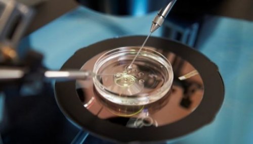 A inseminação artificial: no que consiste e acessibilidade