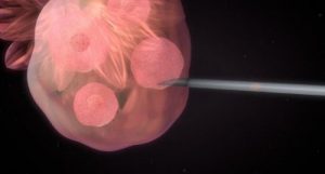 Tudo sobre inseminação artificial