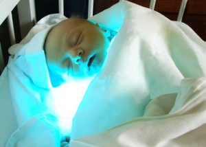 A icterícia infantil