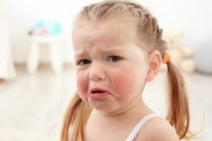 Alergias alimentares em crianças