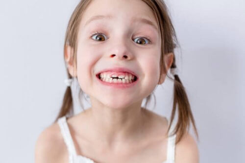 A quedas dos dentes de leite nas crianças