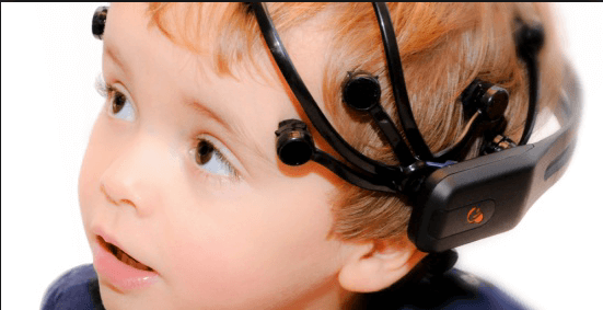 electroencefalograma