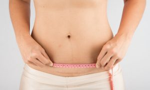 Cuidados com a cicatriz da cesariana após o parto