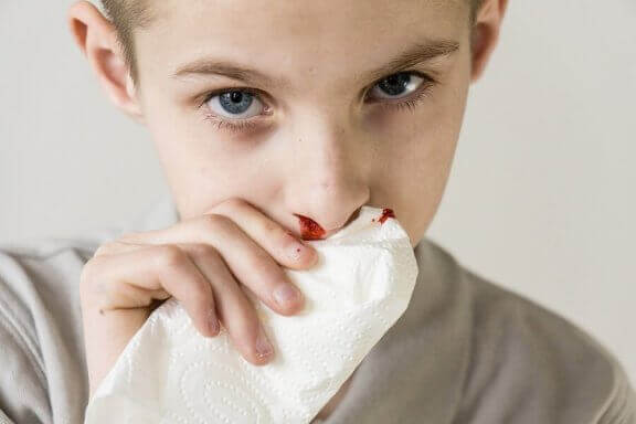 Hemorragia nasal: por que o nariz do seu filho sangra?