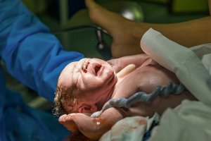 Como é feita a doação do cordão umbilical após o parto?