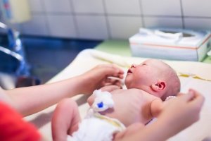 Como cuidar do cordão umbilical do bebê após o parto?