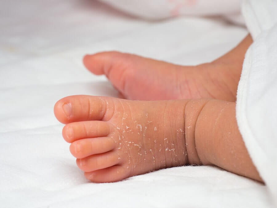 Como cuidar da pele do recém-nascido? - Sou Mamãe