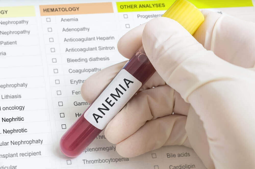 clínica de anemia