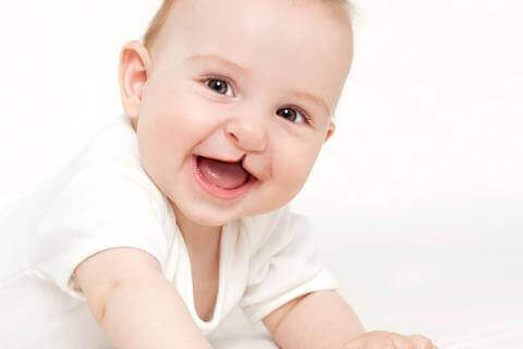 tipos mais comuns de malformações craniofaciais