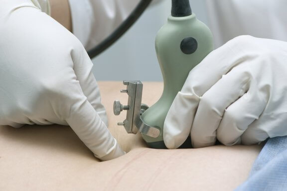 O que é oligoidrâmnio e quais são suas complicações?