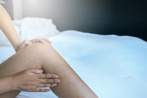 Como eliminar as varizes durante a gravidez?