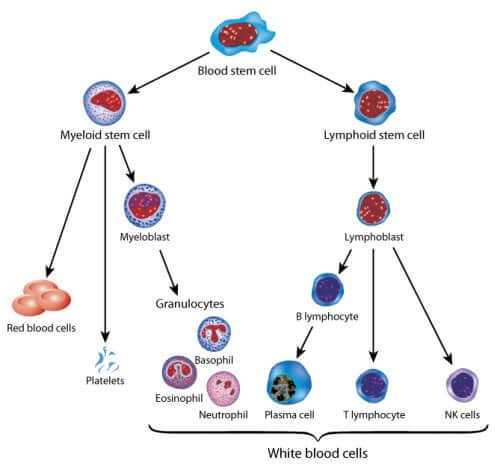 tratamento para a leucemia infantil