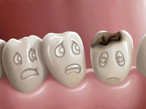 Cáries dentárias: o que são e como evitar?