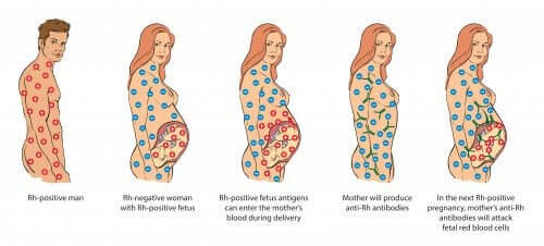 A incompatibilidade sanguínea