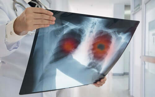 os raios-X afetam a gravidez