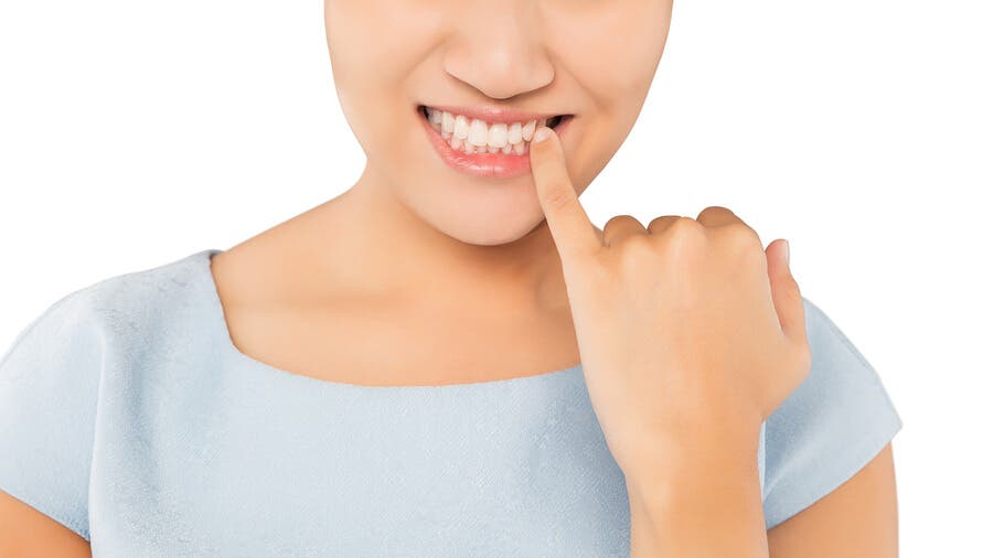 Por que os dentes mudam de cor?