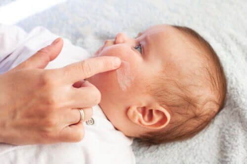 Eczema em bebês: características e cuidados