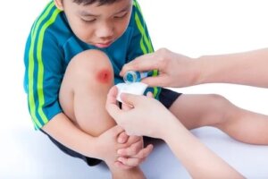 15 dicas básicas para cuidar das feridas das crianças