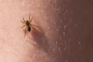 Picadas de pulgas e aranhas em crianças