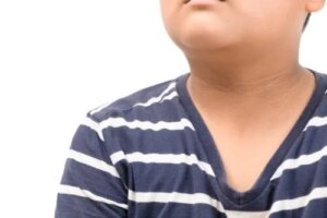 Acantose pigmentar em crianças: características, causas e tratamento