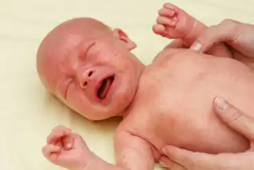 Petéquias no bebê: causas, sintomas e tratamento